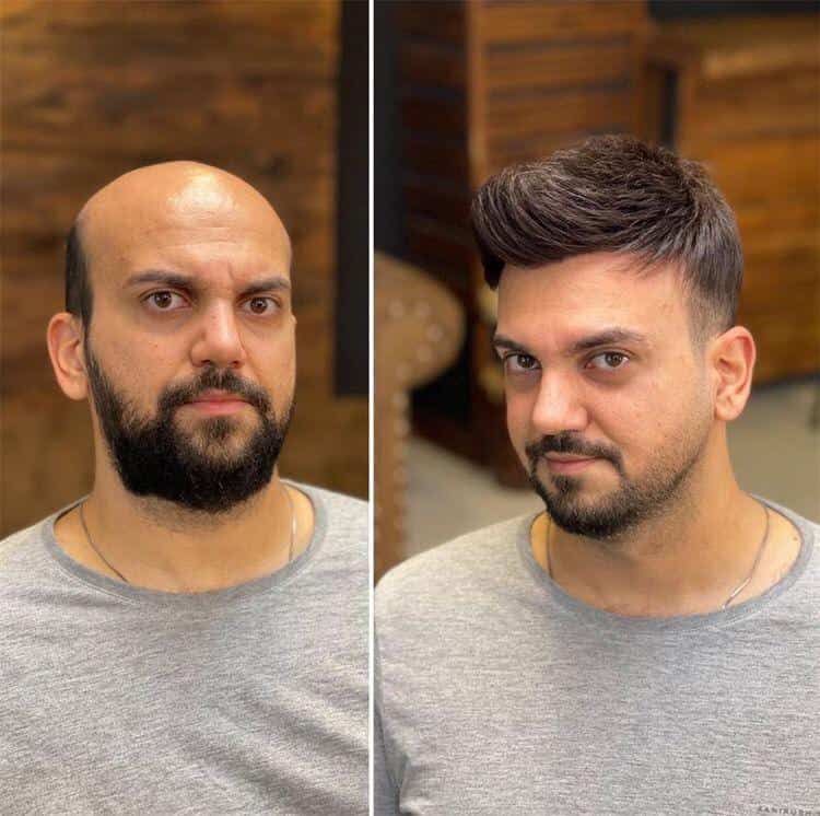 best hair parch offers near me
