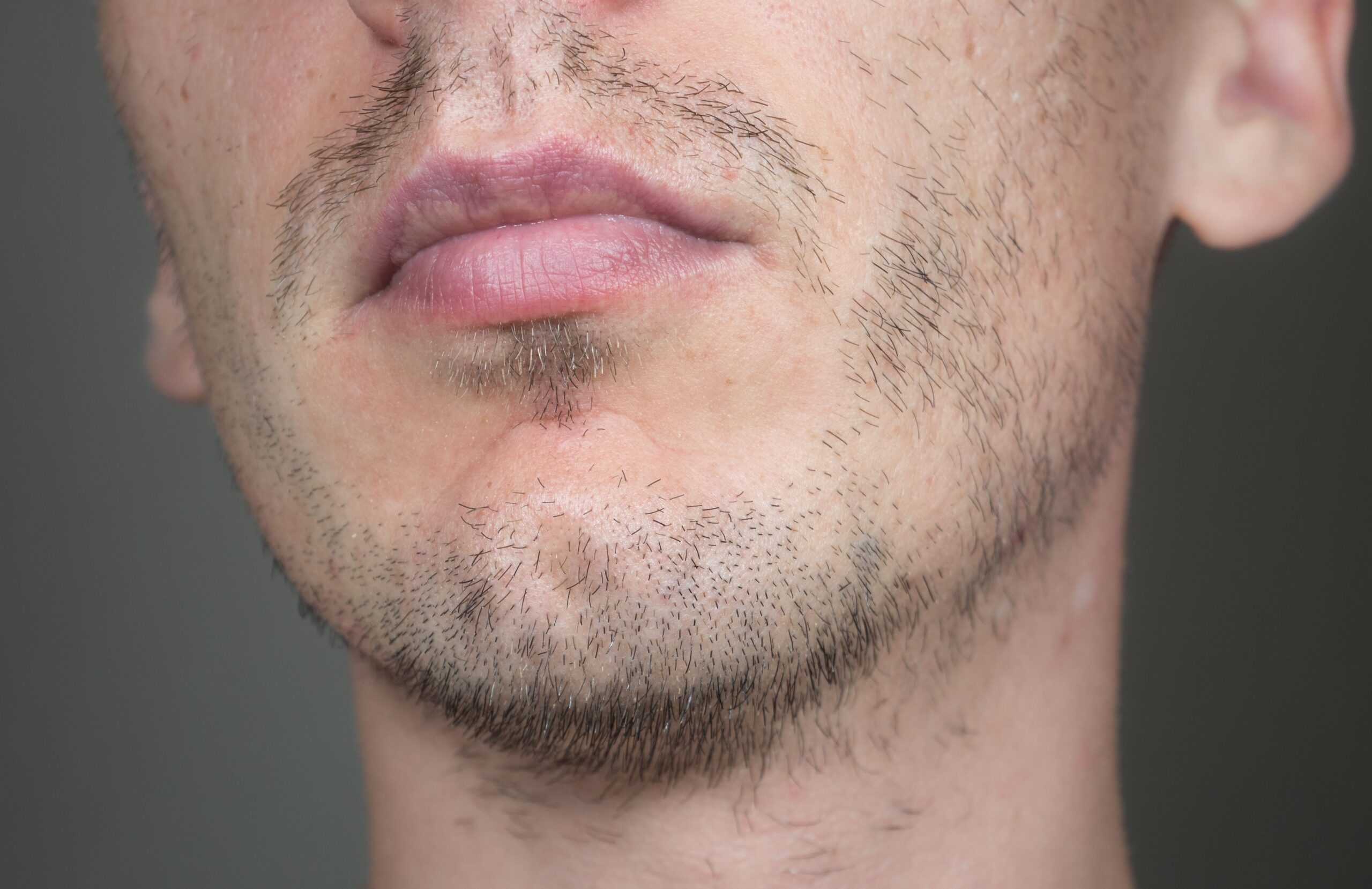 beard patches