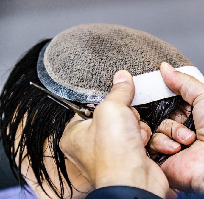why hair patch looks fake