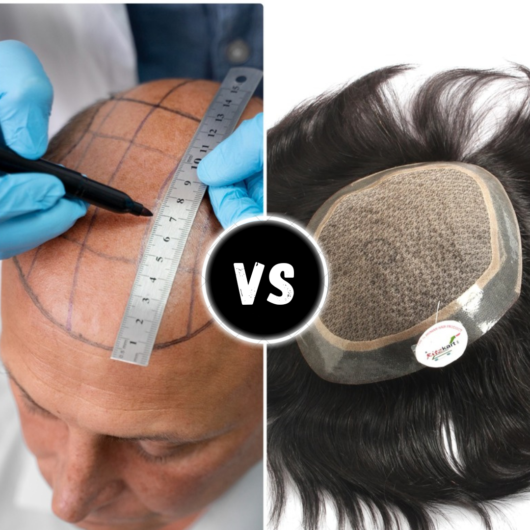 Hair Patch vs Hair Transplant